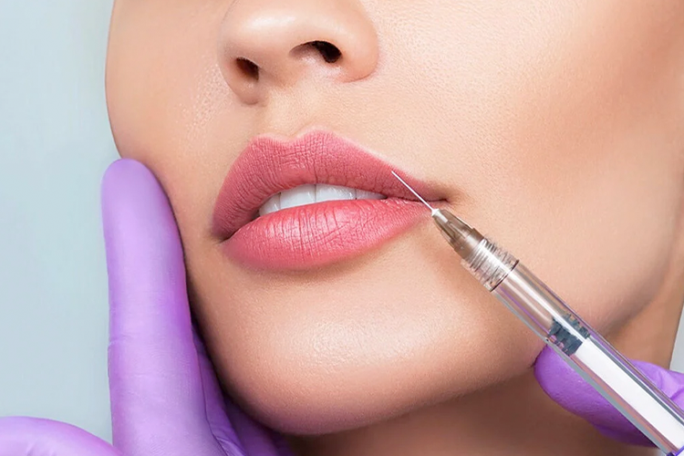 Armonización de Labios: El marco de la sonrisa